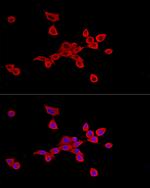 SLC27A2 Antibody in Immunocytochemistry (ICC/IF)
