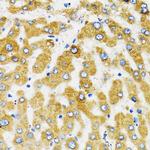 SLC27A2 Antibody in Immunohistochemistry (Paraffin) (IHC (P))