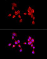 AMBRA1 Antibody in Immunocytochemistry (ICC/IF)