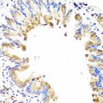 AMBRA1 Antibody in Immunohistochemistry (Paraffin) (IHC (P))