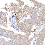 MAGED1 Antibody in Immunohistochemistry (Paraffin) (IHC (P))