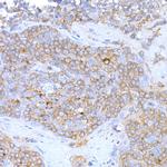 MAGED1 Antibody in Immunohistochemistry (Paraffin) (IHC (P))