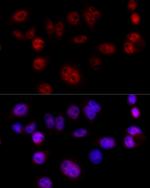 Cyclin D1 Antibody in Immunocytochemistry (ICC/IF)