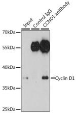 Cyclin D1 Antibody in Immunoprecipitation (IP)