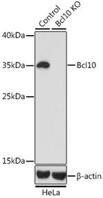 Bcl-10 Antibody in Western Blot (WB)