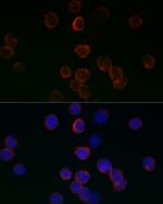 GPX1 Antibody in Immunocytochemistry (ICC/IF)