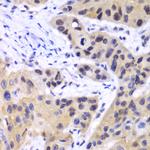 IRF3 Antibody in Immunohistochemistry (Paraffin) (IHC (P))