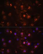 IL-1 beta Antibody in Immunocytochemistry (ICC/IF)