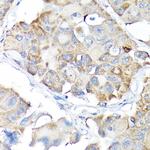 Nrf2 Antibody in Immunohistochemistry (Paraffin) (IHC (P))