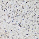 Nrf2 Antibody in Immunohistochemistry (Paraffin) (IHC (P))