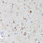 Nrf2 Antibody in Immunohistochemistry (Paraffin) (IHC (P))