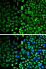 APE1 Antibody in Immunocytochemistry (ICC/IF)