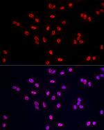POLR2A Antibody in Immunocytochemistry (ICC/IF)