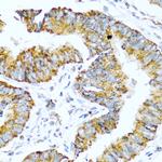 Glucagon Antibody in Immunohistochemistry (Paraffin) (IHC (P))