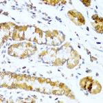 Glucagon Antibody in Immunohistochemistry (Paraffin) (IHC (P))