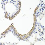 Transthyretin Antibody in Immunohistochemistry (Paraffin) (IHC (P))