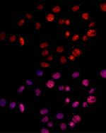 MSH2 Antibody in Immunocytochemistry (ICC/IF)