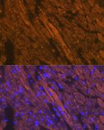 Cardiac Troponin T Antibody in Immunocytochemistry (ICC/IF)