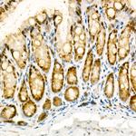 NOX4 Antibody in Immunohistochemistry (Paraffin) (IHC (P))