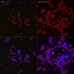 LC3B Antibody in Immunocytochemistry (ICC/IF)