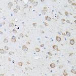 LC3B Antibody in Immunohistochemistry (Paraffin) (IHC (P))