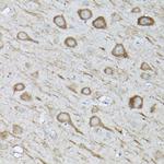 LC3B Antibody in Immunohistochemistry (Paraffin) (IHC (P))