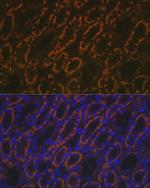 AMACR Antibody in Immunohistochemistry (Paraffin) (IHC (P))