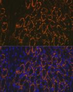 AMACR Antibody in Immunohistochemistry (Paraffin) (IHC (P))