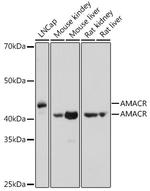 AMACR Antibody in Western Blot (WB)