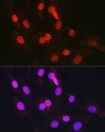 CTCF Antibody in Immunocytochemistry (ICC/IF)