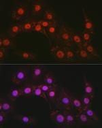 CTCF Antibody in Immunocytochemistry (ICC/IF)