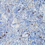 CHOP Antibody in Immunohistochemistry (Paraffin) (IHC (P))