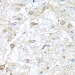 RAC2 Antibody in Immunohistochemistry (Paraffin) (IHC (P))