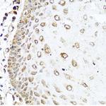 RAC2 Antibody in Immunohistochemistry (Paraffin) (IHC (P))