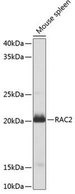 RAC2 Antibody in Western Blot (WB)