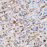 LC3A Antibody in Immunohistochemistry (Paraffin) (IHC (P))