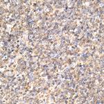 KEAP1 Antibody in Immunohistochemistry (Paraffin) (IHC (P))