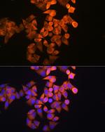 RRM1 Antibody in Immunocytochemistry (ICC/IF)