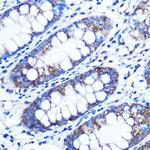 RRM1 Antibody in Immunohistochemistry (Paraffin) (IHC (P))