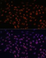 CHD4 Antibody in Immunocytochemistry (ICC/IF)