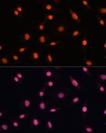 CHD4 Antibody in Immunocytochemistry (ICC/IF)