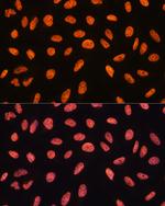 CHD4 Antibody in Immunocytochemistry (ICC/IF)