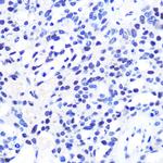 CHD4 Antibody in Immunohistochemistry (Paraffin) (IHC (P))