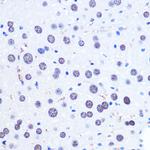 CHD4 Antibody in Immunohistochemistry (Paraffin) (IHC (P))