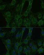 FABP7 Antibody in Immunocytochemistry (ICC/IF)