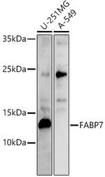 FABP7 Antibody in Western Blot (WB)