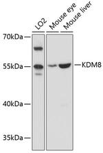 JMJD5 Antibody in Western Blot (WB)