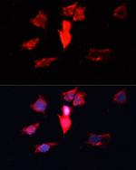 Calmodulin 3 Antibody in Immunocytochemistry (ICC/IF)