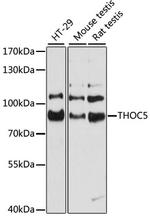 THOC5 Antibody in Western Blot (WB)