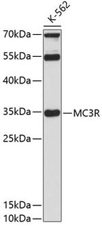 MC3R Antibody in Western Blot (WB)